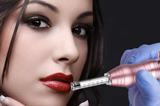 hyaluron pen - Centro Ana Garcia